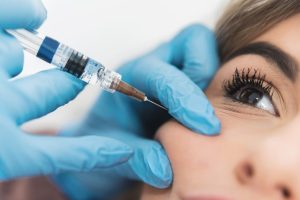 تزریق ژل گونه برای برطرف کردن خط خنده
